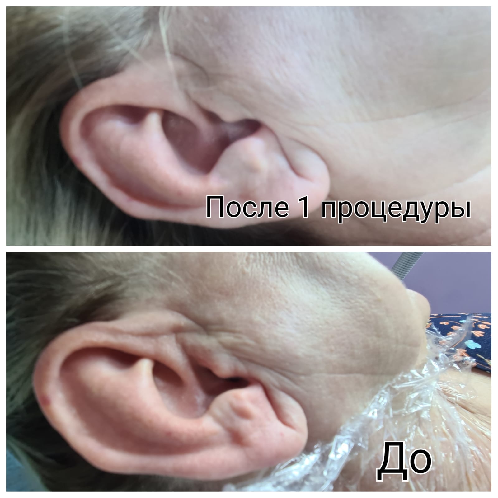 Результаты процедур — до и после