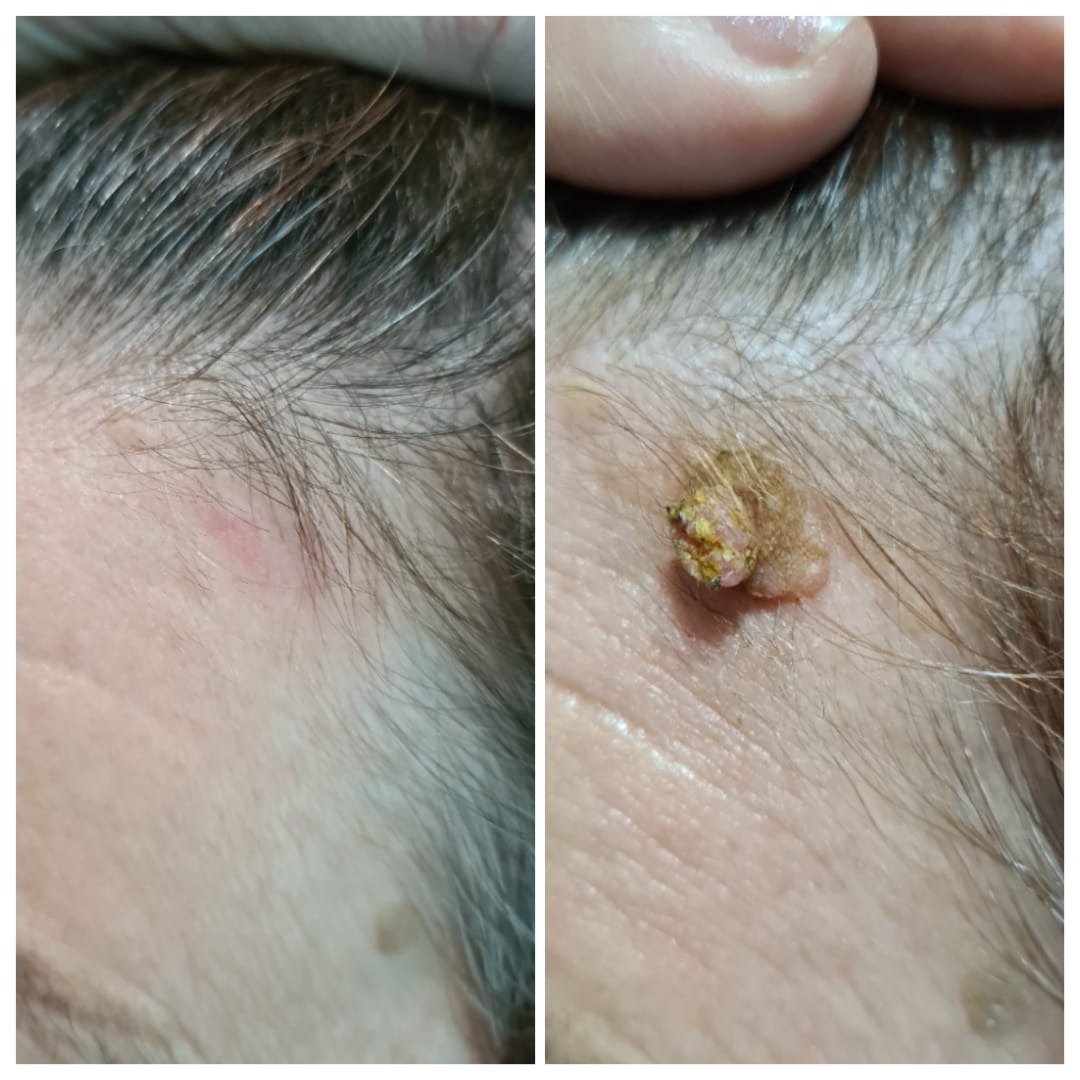 Результаты процедур — до и после